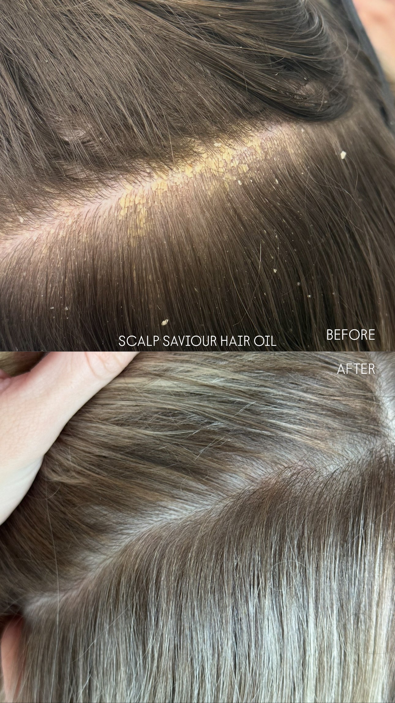 Scalp Saviour Hair Oil